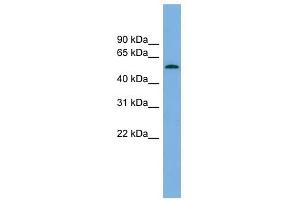GLCCI1 antibody used at 1 ug/ml to detect target protein. (GLCCI1 抗体  (Middle Region))