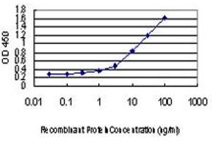 Detection limit for recombinant GST tagged RAD18 is approximately 0. (RAD18 抗体  (AA 332-430))