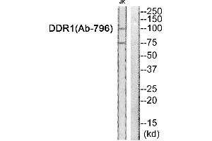 Western blot analysis of extracts from JK cells, using DDR1 (Ab-796) antibody.