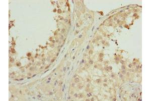 Immunohistochemistry of paraffin-embedded human testis tissue using ABIN7162623 at dilution of 1:100 (PNMA1 抗体  (AA 151-353))