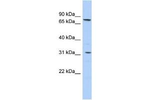 Western Blotting (WB) image for anti-Solute Carrier Family 23 (Nucleobase Transporters), Member 2 (SLC23A2) (Middle Region) antibody (ABIN2781621)