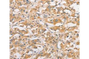 Immunohistochemistry (IHC) image for anti-Toll-Like Receptor 5 (TLR5) antibody (ABIN2422735) (TLR5 抗体)