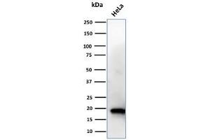 Western Blot Analysis of HeLa cell lysate using NME1 / nm23-H1 Mouse Monoclonal Antibody (CPTC-NME1-2). (NME1 抗体)