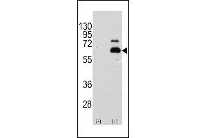 Western blot analysis of RPS6KB1 (arrow) using rabbit polyclonal RPS6KB1 Antibody  (R). (RPS6KB1 抗体  (AA 405-434))