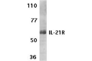 Image no. 1 for anti-Interleukin 21 Receptor (IL21R) (AA 20-32) antibody (ABIN204952) (IL21 Receptor 抗体  (AA 20-32))