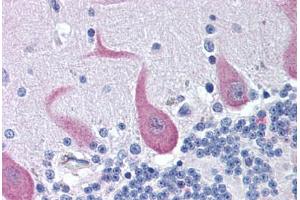 Human Brain, Cerebellum (formalin-fixed, paraffin-embedded) stained with FAIM2 antibody ABIN292115 at 10 ug/ml followed by biotinylated goat anti-rabbit IgG secondary antibody ABIN481713, alkaline phosphatase-streptavidin and chromogen. (FAIM2 抗体  (AA 1-50))