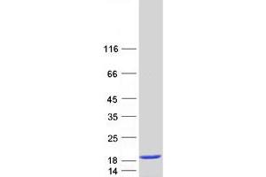 Western Blotting (WB) image for Cellular Retinoic Acid Binding Protein 2 (CRABP2) protein (Myc-DYKDDDDK Tag) (ABIN2712545)