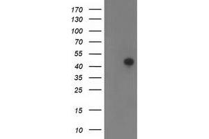 Western Blotting (WB) image for anti-Tropomodulin 1 (TMOD1) antibody (ABIN1501529) (Tropomodulin 1 抗体)