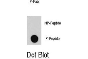 Dot blot analysis of E2F1 (phospho S332) polyclonal antibody  on nitrocellulose membrane. (E2F1 抗体  (pSer332))