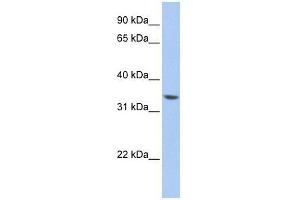 ZNF584 antibody used at 0. (ZNF584 抗体  (Middle Region))