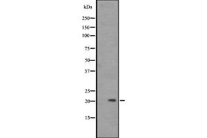 Western blot analysis of PAEP expression in A431 whole cell lysate ,The lane on the left is treated with the antigen-specific peptide. (PAEP 抗体)