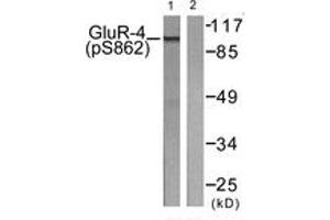 Western blot analysis of extracts from HepG2 cells treated with Forskolin 40nM 30', using GluR4 (Phospho-Ser862) Antibody. (GRIA4 抗体  (pSer862))