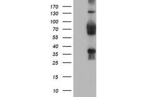 Western Blotting (WB) image for anti-Transducin-Like Enhancer Protein 2 (TLE2) antibody (ABIN1501408) (TLE2 抗体)