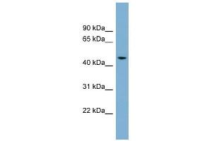 ACTR3B antibody used at 1 ug/ml to detect target protein. (ACTR3B 抗体)