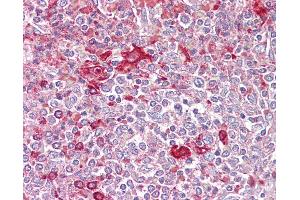 Anti-TLR5 antibody IHC of human spleen. (TLR5 抗体  (AA 300-350))