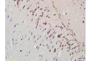 Formalin-fixed and paraffin embedded rat brain labeled with Rabbit Anti-APP/Amyloid Precursor Protein Polyclonal Antibody (ABIN725120) at 1:200 followed by conjugation to the secondary antibody and DAB staining.