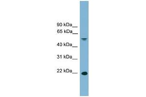 WB Suggested Anti-HDGFRP3 Antibody Titration: 0. (HDGFRP3 抗体  (Middle Region))