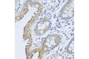 Immunohistochemistry of paraffin-embedded human colon using CRA antibody (ABIN6132087, ABIN6138999, ABIN6139001 and ABIN6217973) at dilution of 1:150 (40x lens). (EFCAB4B 抗体  (AA 1-200))