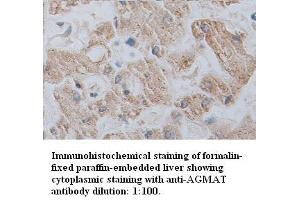 Image no. 1 for anti-Agmatine Ureohydrolase (Agmatinase) (AGMAT) antibody (ABIN1574528) (AGMAT 抗体)