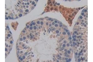Detection of DAPP1 in Mouse Testis Tissue using Polyclonal Antibody to Dual Adaptor Of Phosphotyrosine And 3-Phosphoinositides (DAPP1)