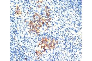 Immunohistochemistry of paraffin-embedded Mouse spleen using THBS1 Polyclonal Antibody at dilution of 1:200 (40x lens). (Thrombospondin 1 抗体)