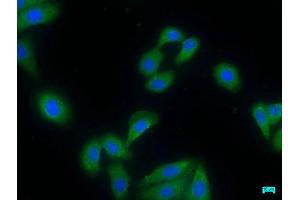 Immunofluorescence staining of HepG2 cells with ABIN7155164 at 1:50, counter-stained with DAPI. (PDE8A 抗体  (AA 596-829))