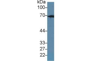Western Blot; Sample: Rat Liver lysate; Primary Ab: 1µg/ml Rabbit Anti-Rat KRT2 Antibody Second Ab: 0. (Keratin 2 抗体  (AA 508-685))
