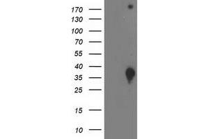 Image no. 2 for anti-DnaJ (Hsp40) Homolog, Subfamily B, Member 2 (DNAJB2) antibody (ABIN1497868) (DNAJB2 抗体)
