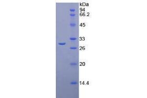 Chymotrypsin C (Caldecrin) (CTRC) (AA 30-268) (Active) protein (His tag)