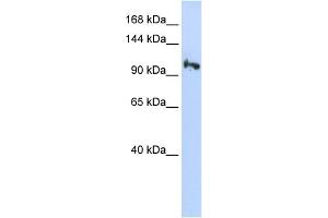 WB Suggested Anti-SMG5 Antibody Titration: 0. (SMG5 抗体  (N-Term))