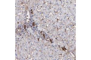 Immunohistochemical staining of human liver with ACTN4 polyclonal antibody  shows strong cytoplasmic and membranous positivity in lymphoid tissue in bile duct cells at 1:1000-1:2500 dilution. (alpha Actinin 4 抗体)