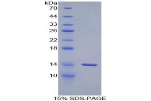 SDS-PAGE analysis of Rat GnRH Protein. (GNRH1 蛋白)