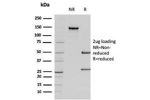 SDS-PAGE Analysis Purified Smooth Muscle Actin Mouse Monoclonal Antibody (SPM322). (Smooth Muscle Actin 抗体  (N-Term))