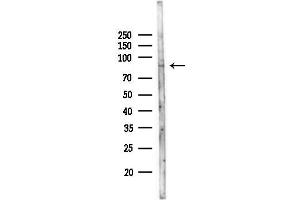 Western blot analysis of lysates from MCF7 cells(heat-shock,45 min treatment), using SPG7 Antibody at 1/1000 dilution.