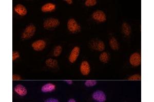 Immunofluorescence analysis of U-2 OS cells using RPP38 Polyclonal Antibody at dilution of 1:100. (RPP38 抗体)