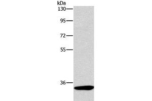 Western Blot analysis of Mouse kidney tissue using NCR1 Polyclonal Antibody at dilution of 1:450 (NCR1 抗体)