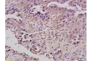 Formalin-fixed and paraffin embedded rat kidney labeled with Anti-FPR1 Polyclonal Antibody, Unconjugated (ABIN742245) at 1:200 followed by conjugation to the secondary antibody and DAB staining (FPR1 抗体)
