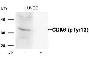 Western blot analysis of extracts from HUVEC cells, treated with calf intestinal phosphatase (CIP), using CDK6 (phospho-Tyr13) Antibody. (CDK6 抗体  (pTyr13))