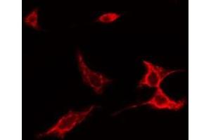 ABIN6275526 staining NIH-3T3 cells by IF/ICC. (SPINK5 抗体  (N-Term))
