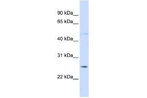 RNF170 antibody used at 1 ug/ml to detect target protein. (RNF170 抗体  (C-Term))