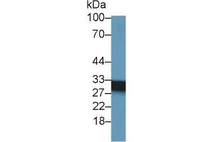 Western Blotting (WB) image for anti-Succinate Dehydrogenase Complex, Subunit B, Iron Sulfur (Ip) (SDHB) (AA 97-282) antibody (ABIN7441589)