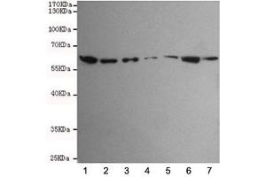 Western blot testing of human 1) HCT116, 2) SW480, 3) HepG2, 4) A549, 5) Jurkat, 6) K562 and 7) HeLa cell lysates using TAB1 antibody at 1:1000.