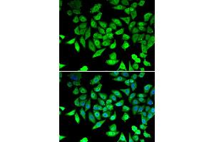 Immunofluorescence analysis of U2OS cells using CCAR2 antibody. (CCAR2 抗体)