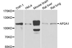 Western blot analysis of extracts of various cell lines, using AP2A1 antibody (ABIN5975765) at 1/1000 dilution. (alpha Adaptin 抗体)