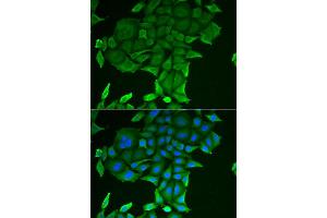 Immunofluorescence analysis of HeLa cell using CD84 antibody. (CD84 抗体)