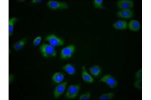 Immunofluorescence staining of A549 cells with ABIN7158892 at 1:166, counter-stained with DAPI. (MPEG1 抗体  (AA 537-633))