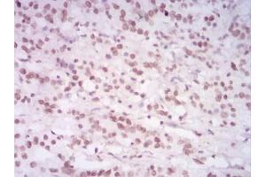 Immunohistochemistry (IHC) image for anti-Histone Cluster 2, H4a (HIST2H4A) (meLys20) antibody (ABIN5684092)