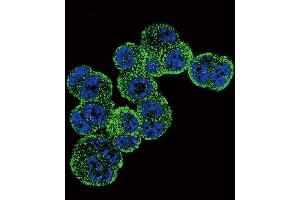 Immunofluorescence (IF) image for anti-Alcohol Dehydrogenase 1C (Class I), gamma Polypeptide (ADH1C) (AA 231-260) antibody (ABIN651725)