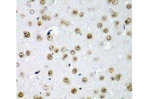 Immunohistochemistry of paraffin-embedded Rat brain using SF3B3 Polyclonal Antibody at dilution of 1:200 (40x lens). (SF3B3 抗体)