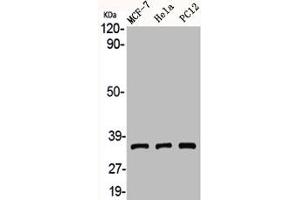 Western Blot analysis of MCF7 HELA PC12 cells using Adenosine A3-R Polyclonal Antibody